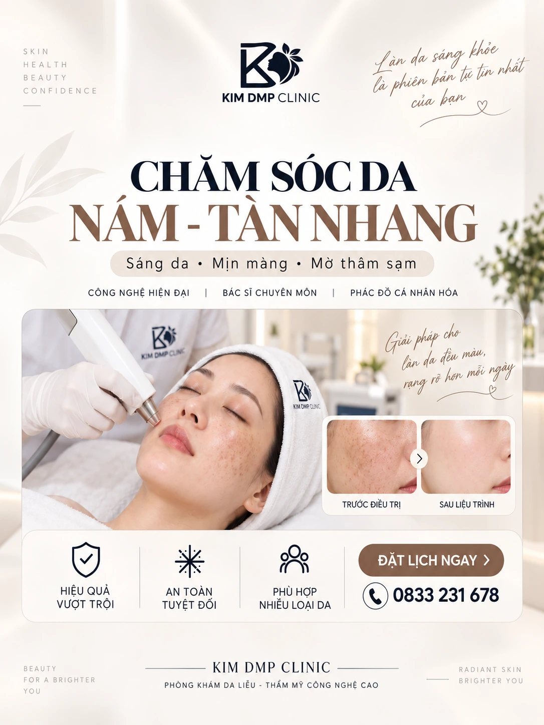Tàn nhang - đồi mồi tại phòng khám da liễu Kim DMP Gò Vấp