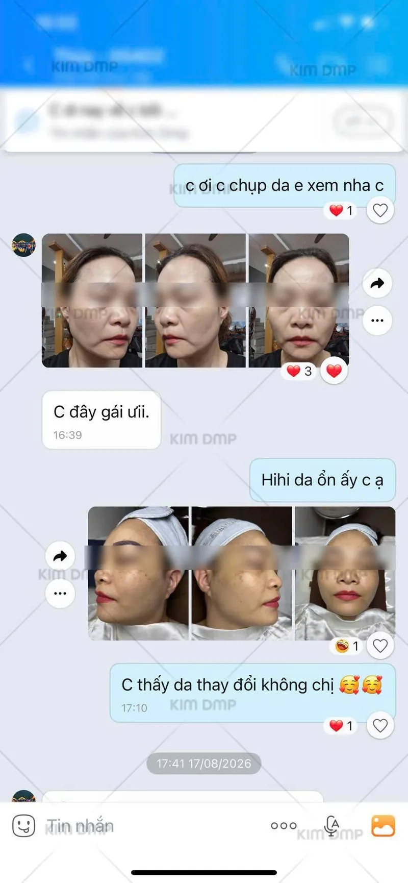 Khách hàng nhắn lại về thay đổi của làn da sau khi chăm sóc