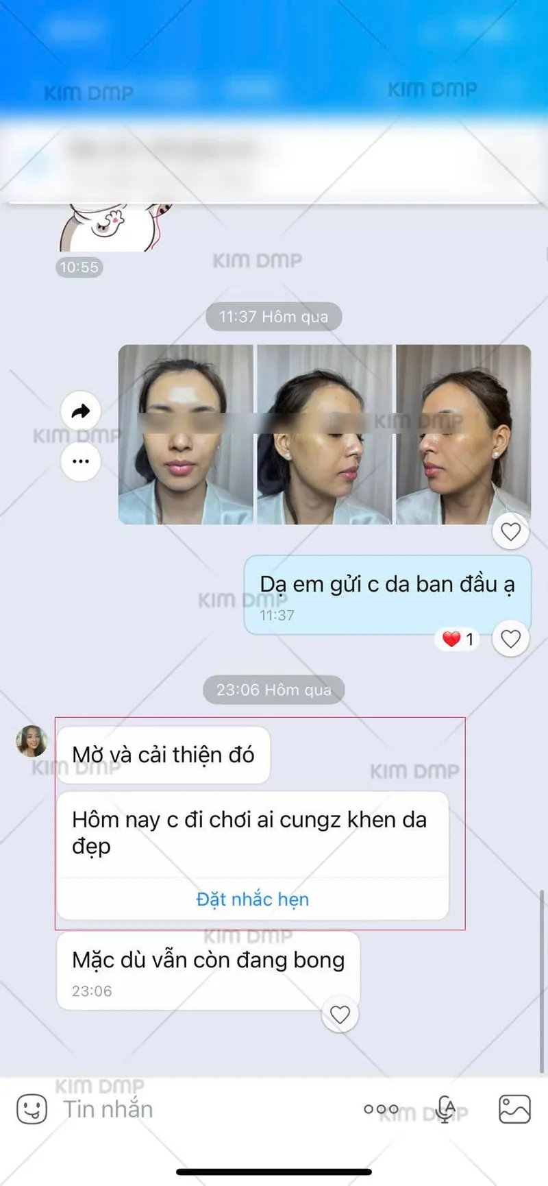 Khách hàng nhắn lại da đã mờ và cải thiện sau khi chăm sóc tại Kim DMP